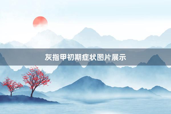 灰指甲初期症状图片展示